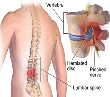 Spine-Surgery