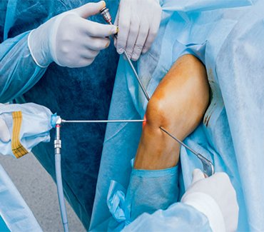 arthroscopic knee