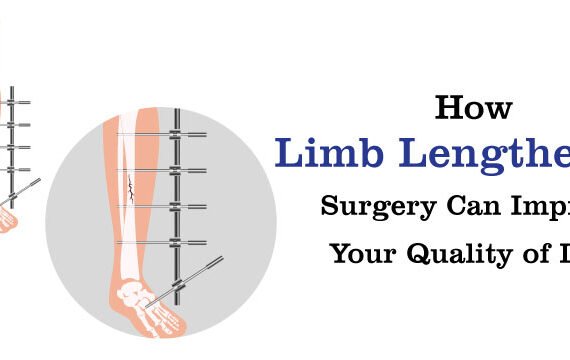 How Limb Lengthening Surgery Can
