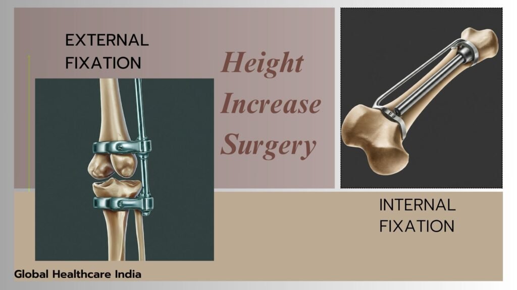 External vs. Internal Fixation