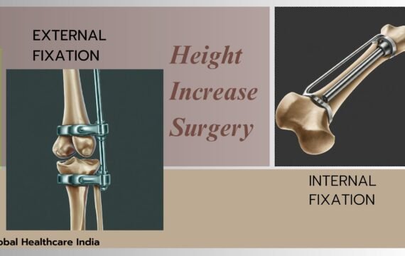 External vs. Internal Fixation