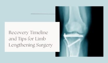 Recovery Timeline and Tips for Limb Lengthening Surgery