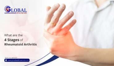 4 Stages of Rheumatoid Arthritis GHTC