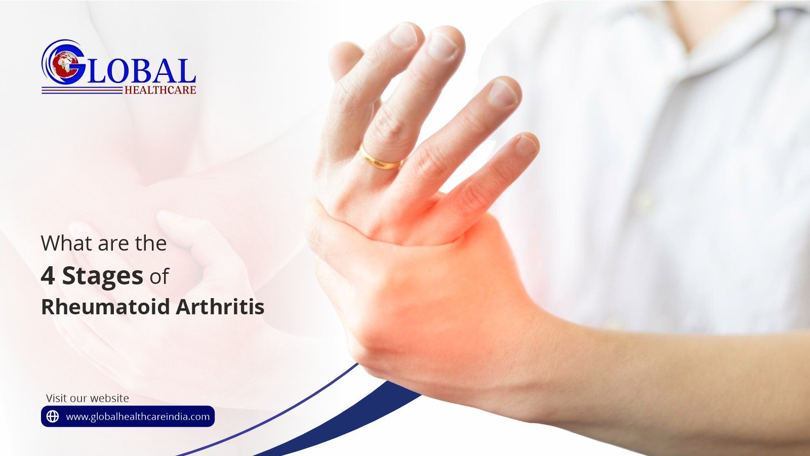 4 Stages of Rheumatoid Arthritis GHTC