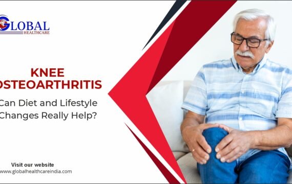 Knee Osteoarthritis: Can Diet and Lifestyle Changes Really Help?