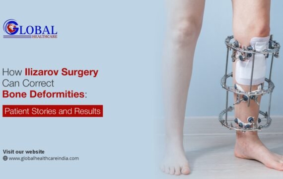 How Ilizarov Surgery Can Correct Bone Deformities