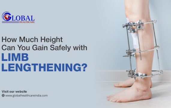 How Much Height Can You Gain Safely with Limb Lengthening?