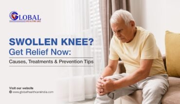 Swollen Knee? Get Relief Now: Causes, Treatments & Prevention Tips