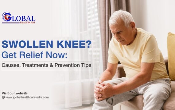 Swollen Knee? Get Relief Now: Causes, Treatments & Prevention Tips