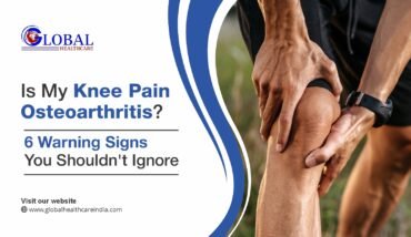 Knee Pain Osteoarhritis